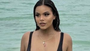 Gracie Bon Avant Chirurgie