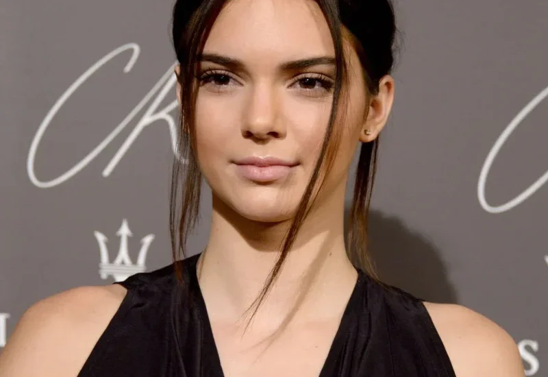 Kendall Jenner Avant Chirurgie