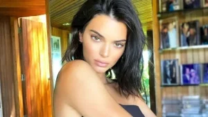 Kendall Jenner Chirurgie